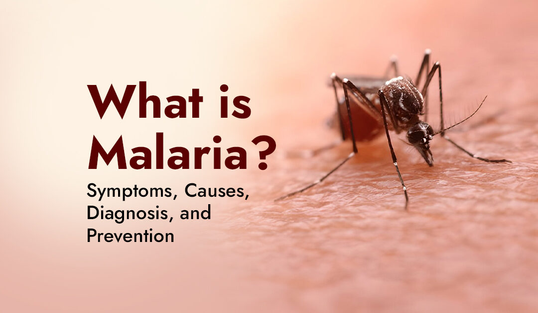 What is Malaria? Symptoms, Causes, Diagnosis, and Prevention