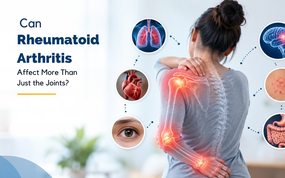  Can Rheumatoid Arthritis Affect More Than Just the Joints?